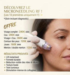 microneedling rf
